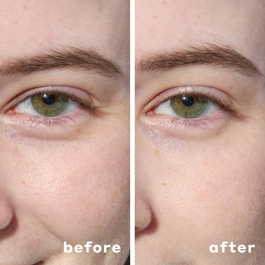 Wake Up Bright-Eyed: Best Under Eye Masks for Dark Circles, Puffiness & Wrinkles