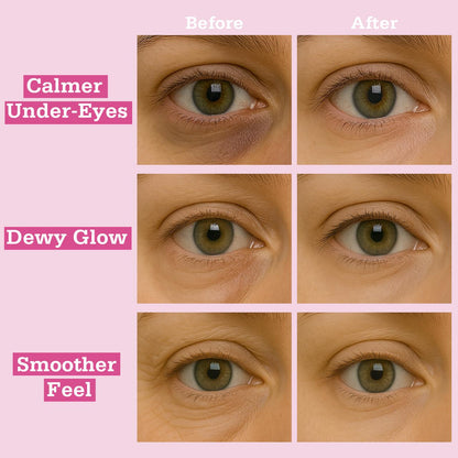 Rosy Posey Hydrogel Eye Patches
