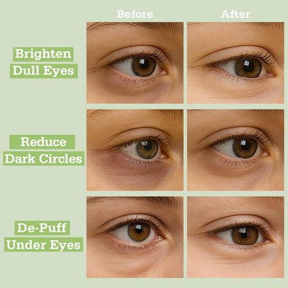 SoMatcha Hydrogel Eye Patches