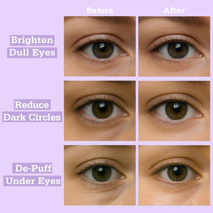 Lavender Pop Hydrogel Eye Patches