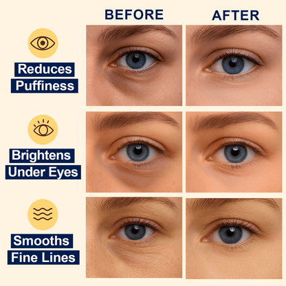 Lunara & Solara Hydrogel Eye Patches