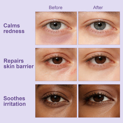 Crystal Collection · Amethyst Haze Hydrogel Under-Eye Patches