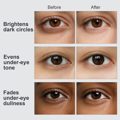 Crystal Collection · Prism Glow Hydrogel Under-Eye Patches