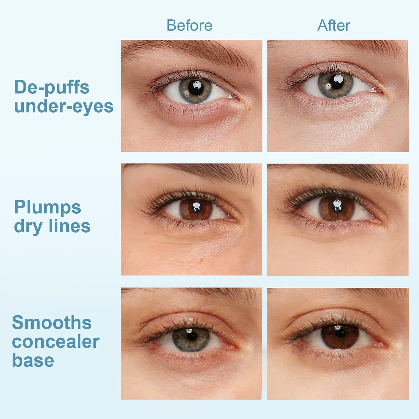 Hydraverse¹ · Surface Phase Hydrogel Under-Eye Patches