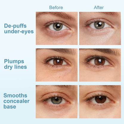 Hydraverse¹ · Surface Phase Hydrogel Under-Eye Patches
