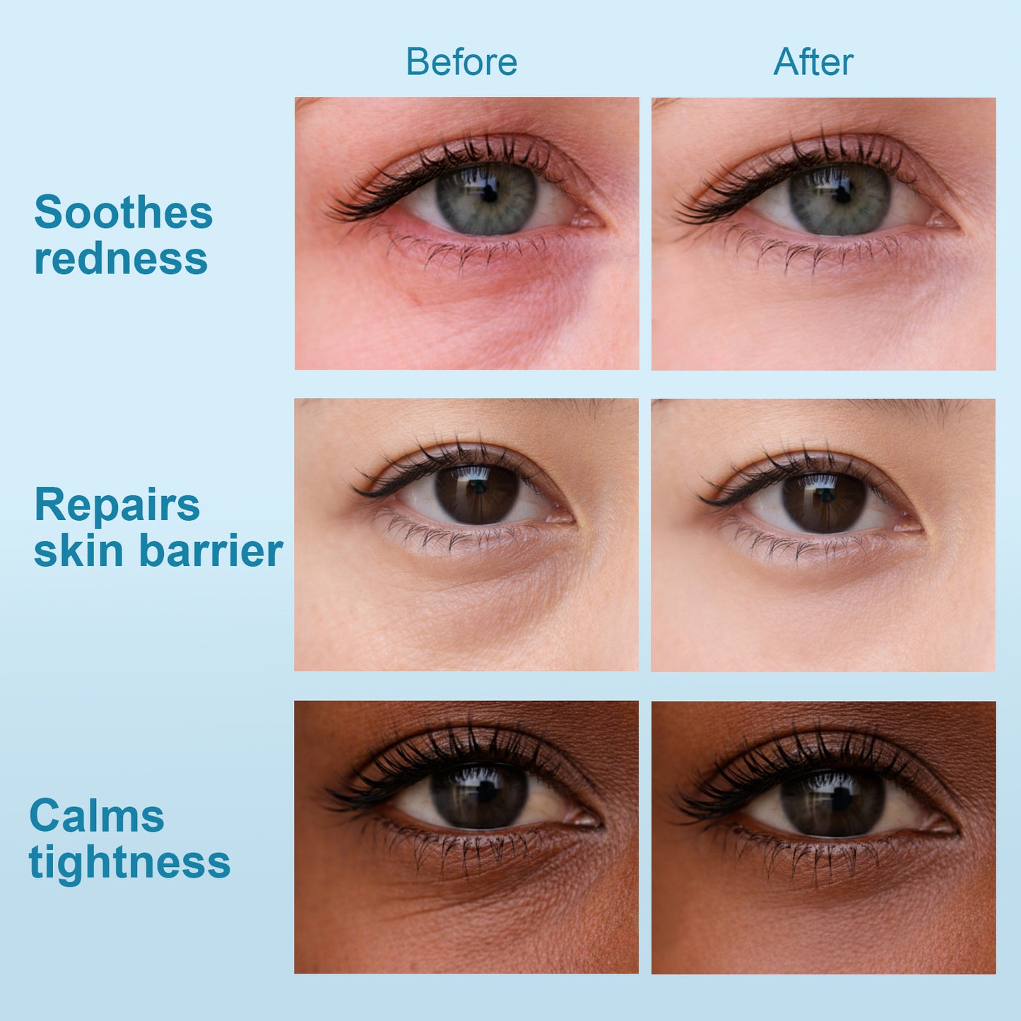 Hydraverse² · Deep Phase Hydrogel Under-Eye Patches