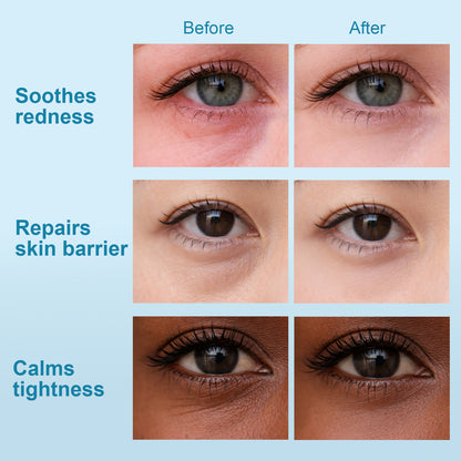 Hydraverse² · Deep Phase Hydrogel Under-Eye Patches