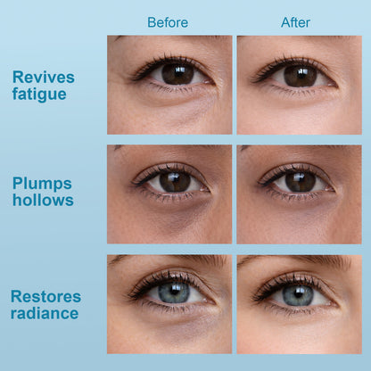 Hydraverse³ · Abyssal Phase Hydrogel Under-Eye Patches
