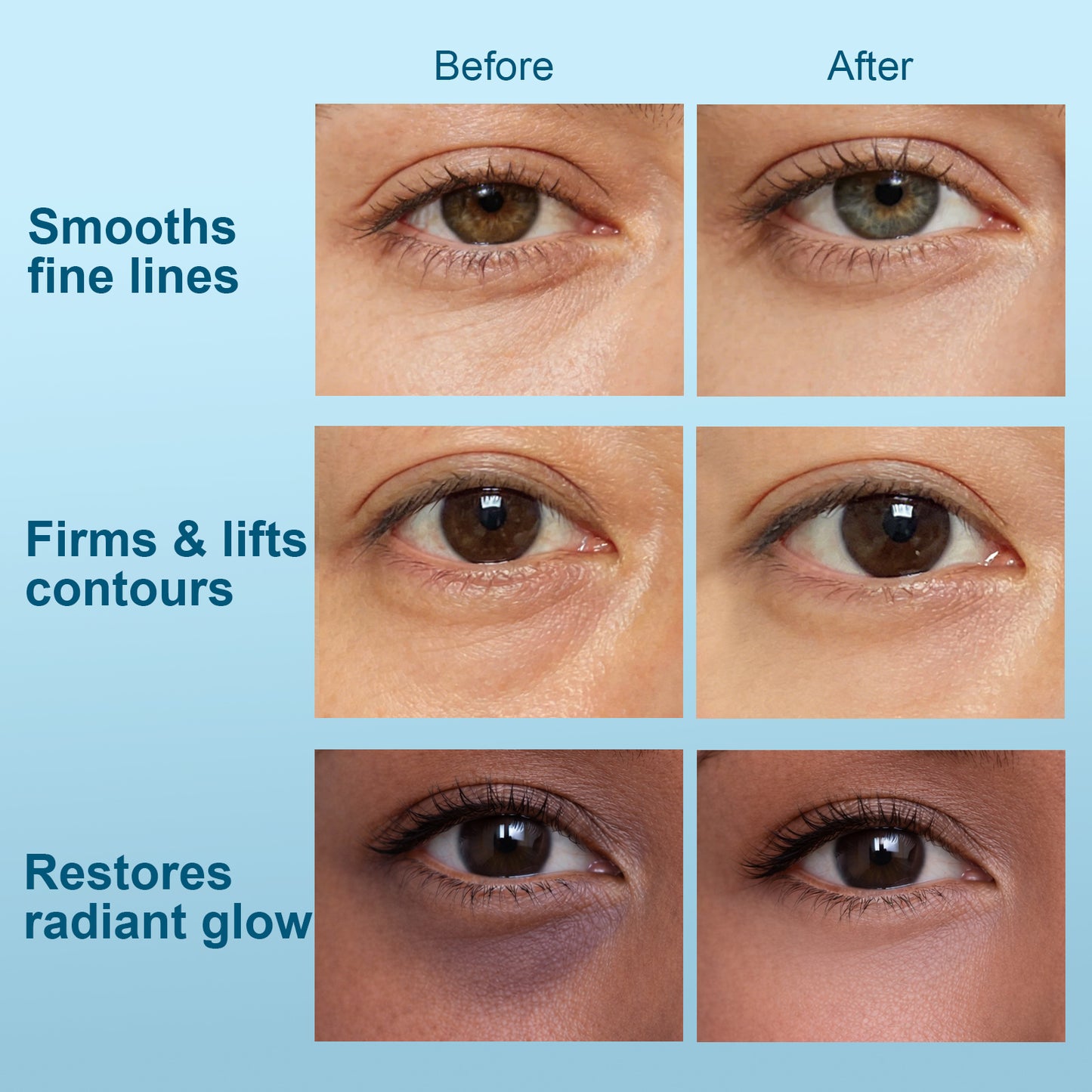 Hydraverse⁴ · Quantum Phase Hydrogel Under-Eye Patches