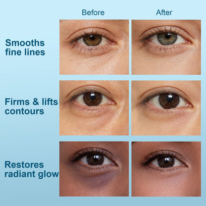 Hydraverse⁴ · Quantum Phase Hydrogel Under-Eye Patches