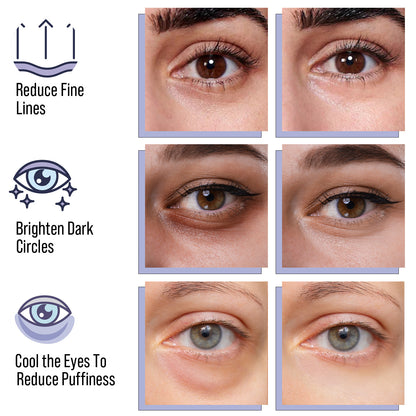 DIAMOND GAZE Hydrogel Eye Mask